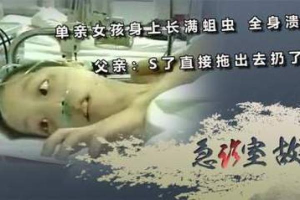 梦到身上有蛆虫